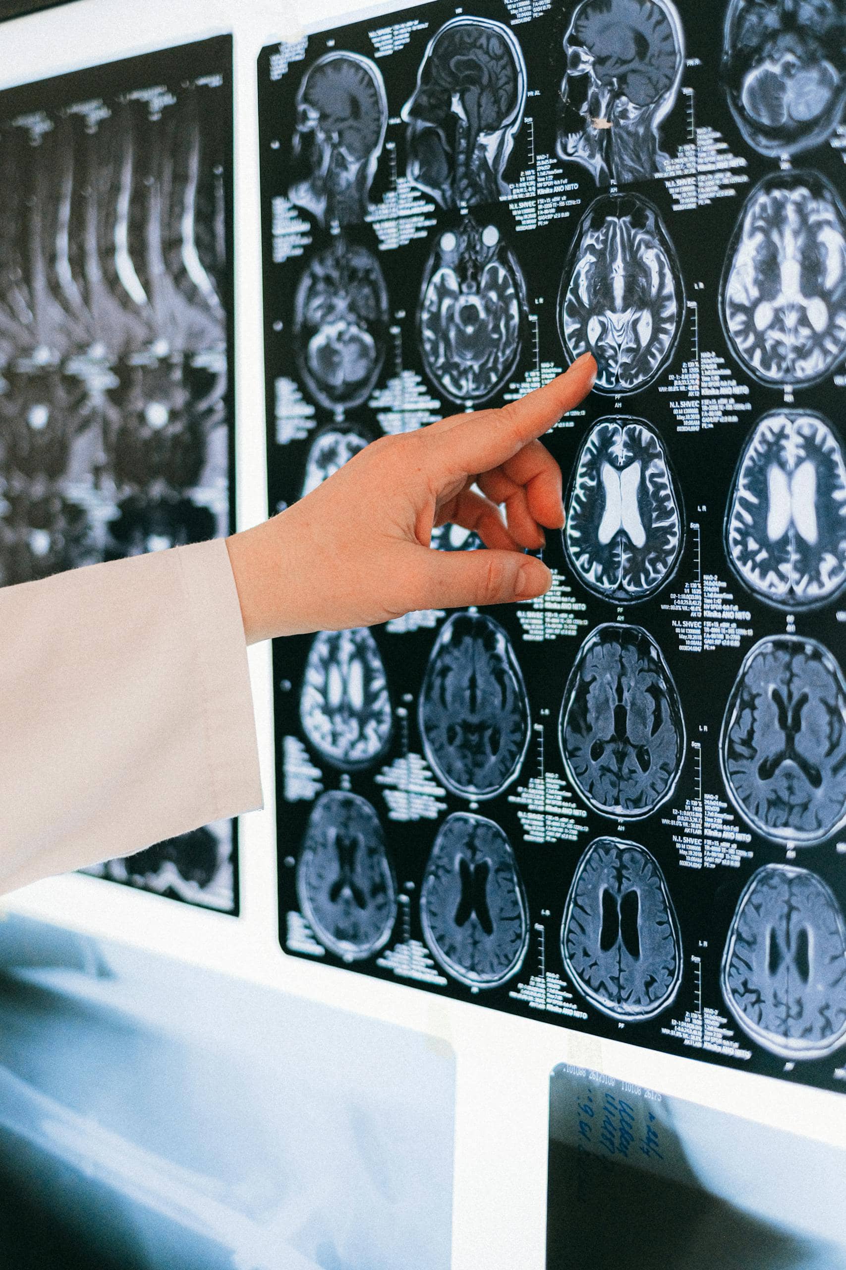 What Neuroscience and Tradition Both Say About Ayahuasca
